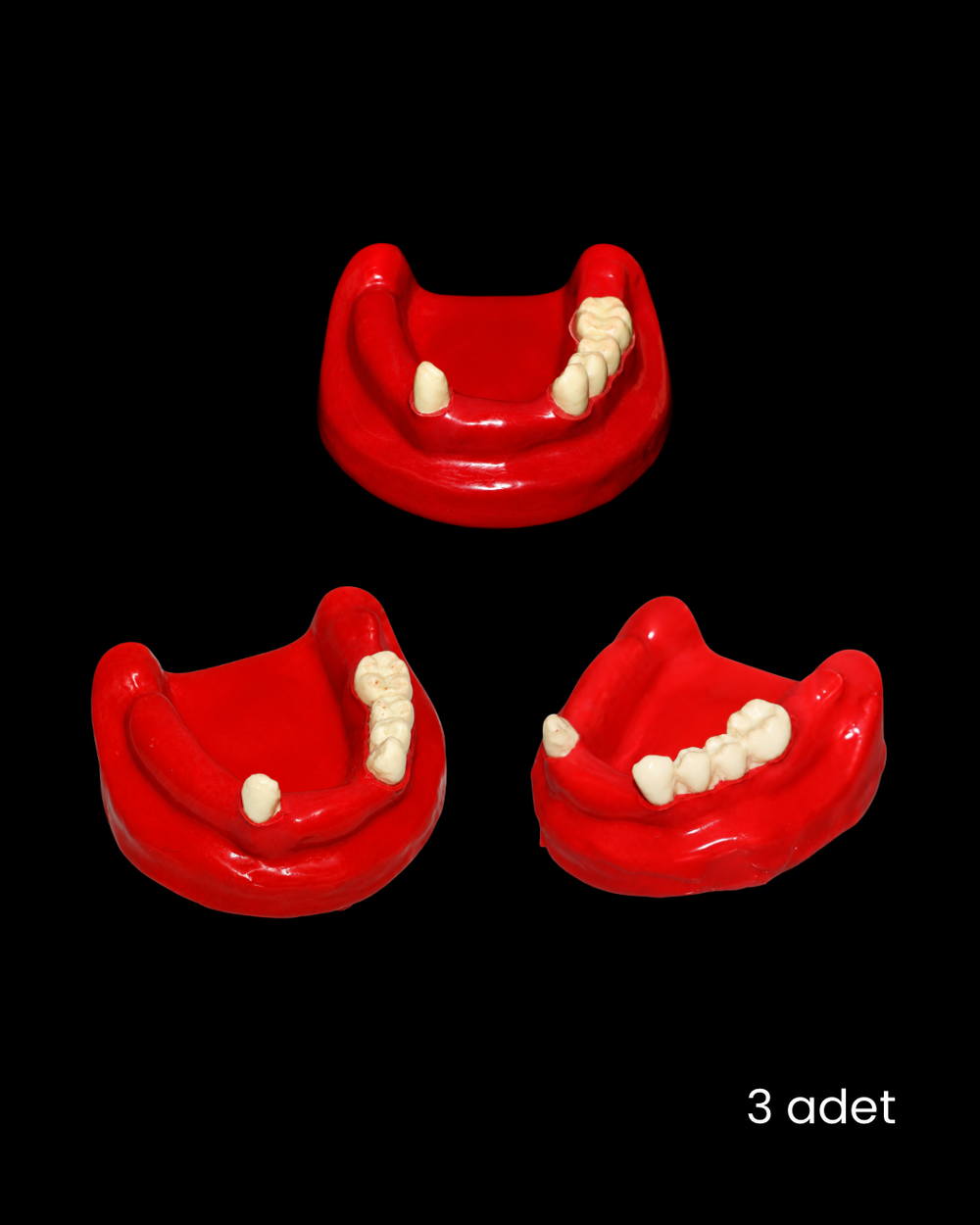 Gömülü Dişli Yumuşak Dokulu Kısmi Dişsiz 3’lü Alt Çene Modeli