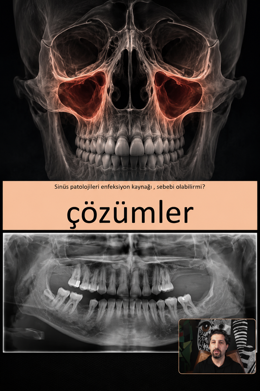 Maksiller Sinüs Lifting Kursu