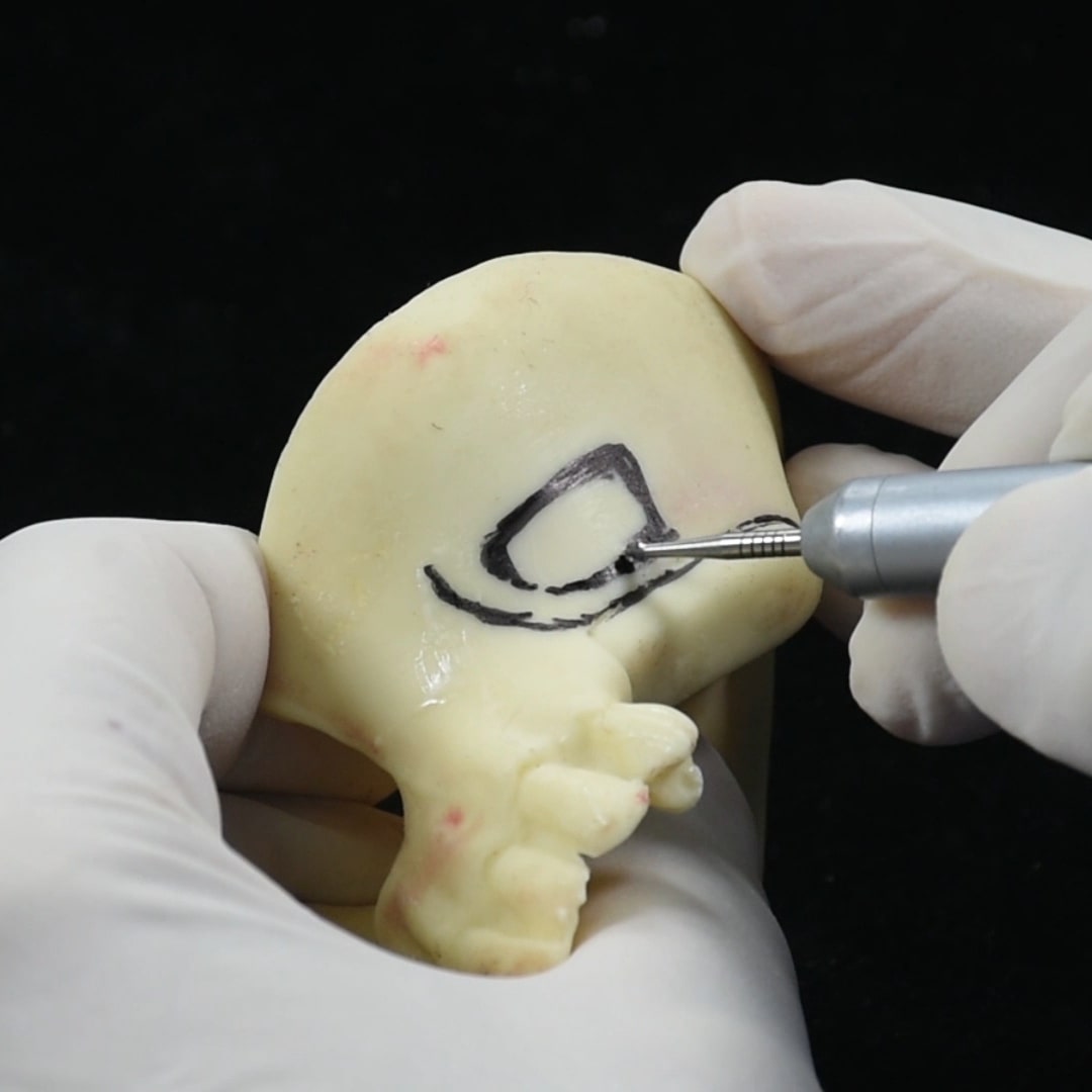 sinus-lifting-online-kurs